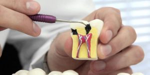 endodontia