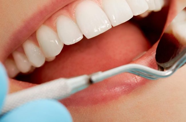 Mês do dentista: por que procurar um especialista?